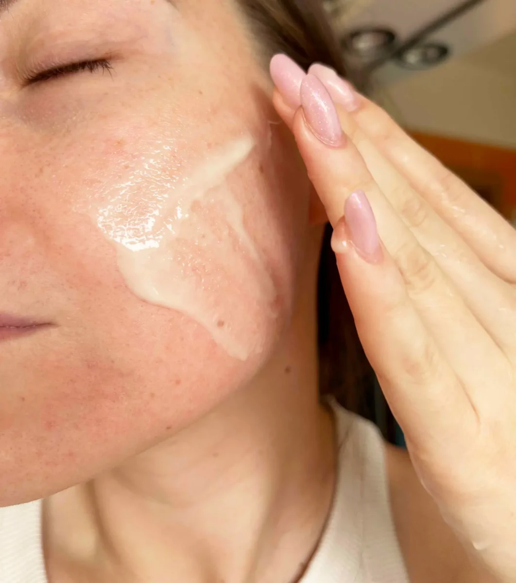 Co pomáhá na černé tečky? Proklepli jsme 4 přírodní produkty a po 14 dnech viděli výsledky 10 IMG 3467 1 1062x1200 2